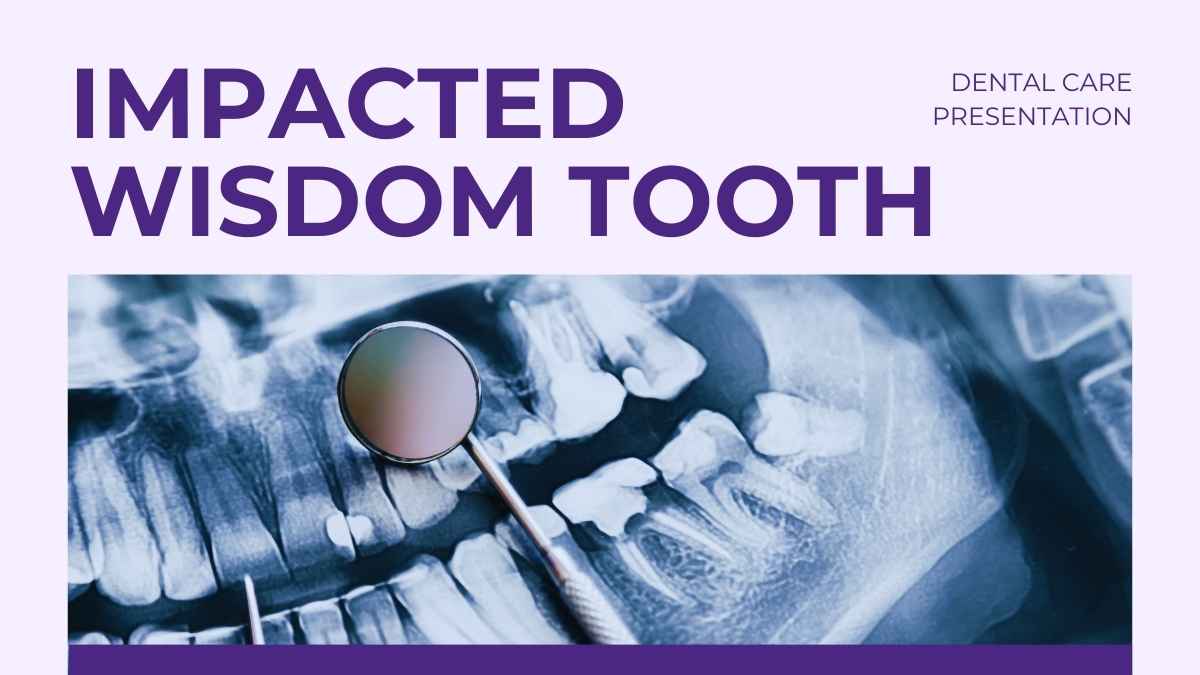 Simple Impacted Wisdom Teeth Slides Preview